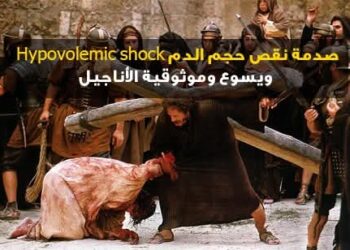 صدمة نقص حجم الدم Hypovolemic shock ويسوع وموثوقية الأناجيل
